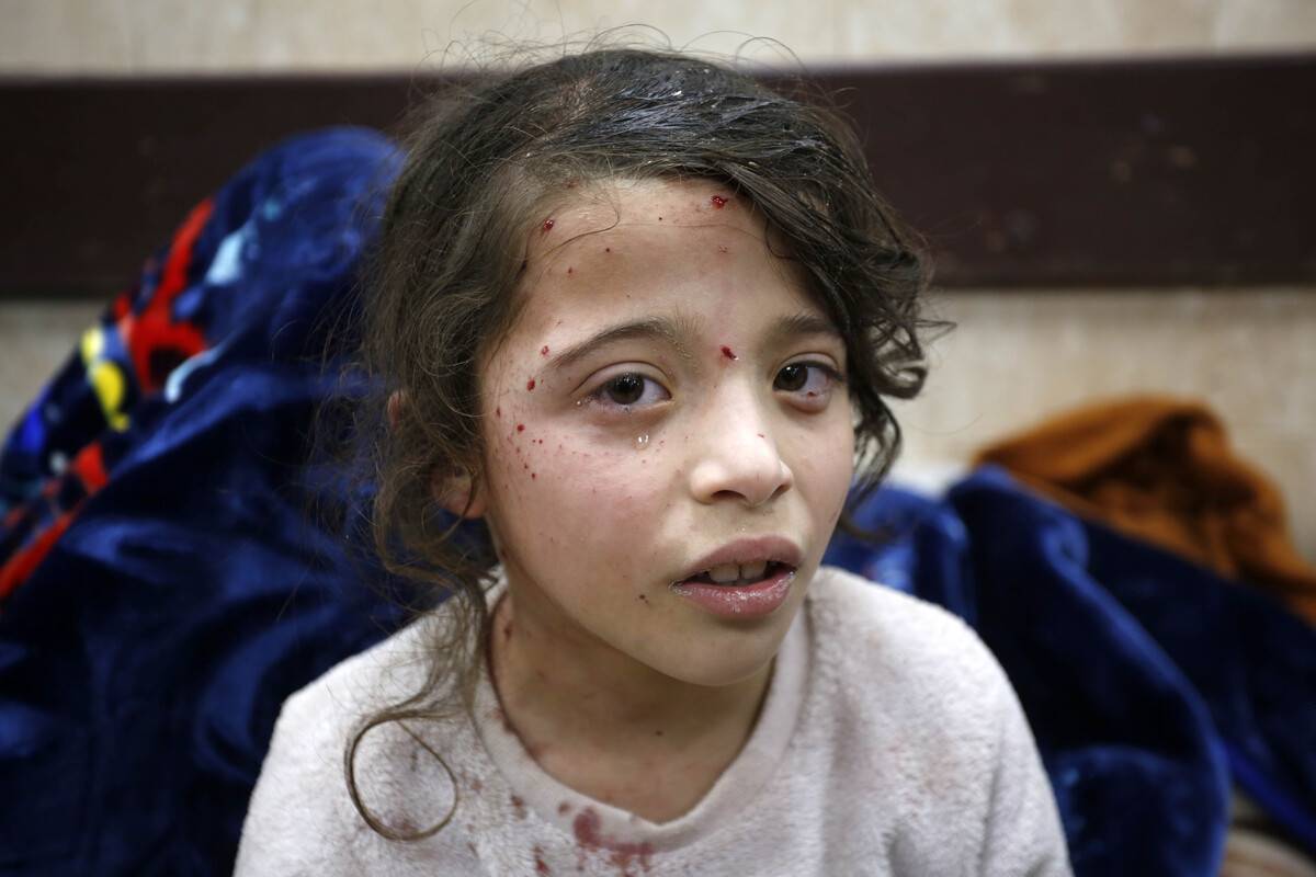 gaza-s-injured-children-face-nightmares-trauma-amid-escalating-israel